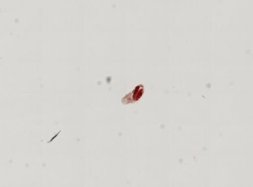 Trematoda