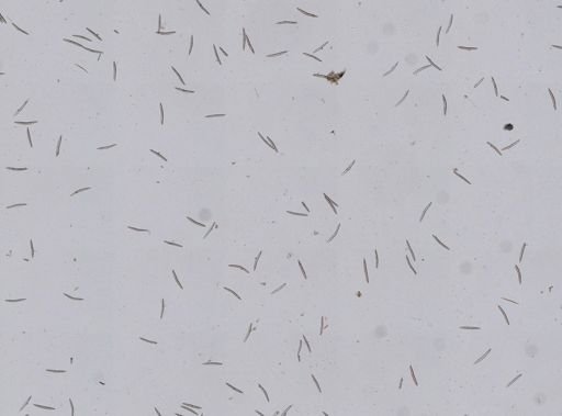 Haliclona oculata