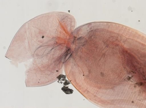 Oligacanthorhynchus microcephalus