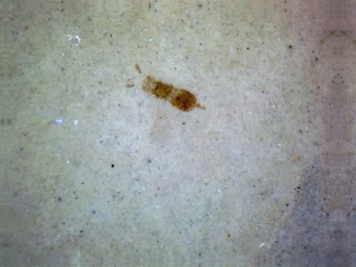 undet. Hymenoptera