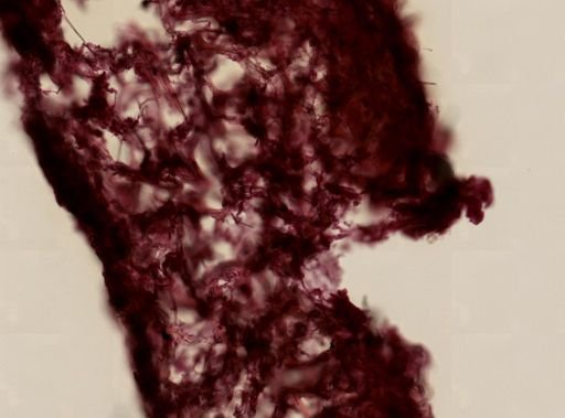 Callyspongia vaginalis
