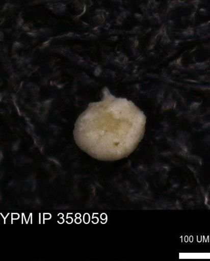 undet. Foraminiferida