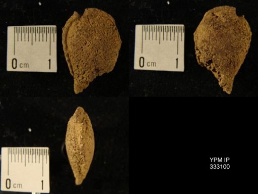 Amygdalocystites?