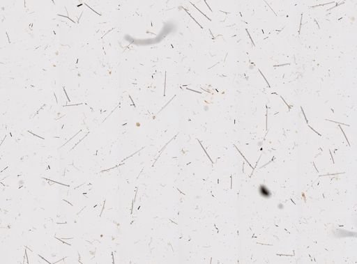 Cliona vermifera