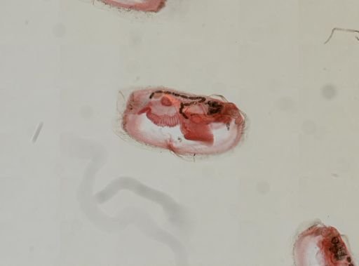 Ostracoda?