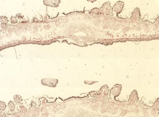 Thysanozoon brocchii
