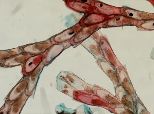 Bugula neritina