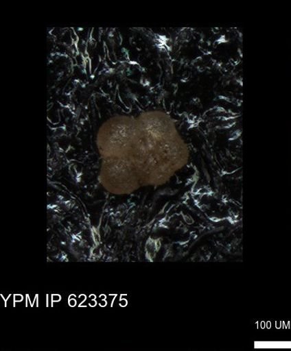 undet. Globigerinina