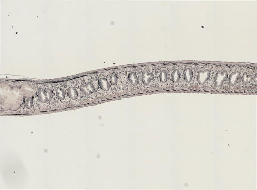 Turbellaria