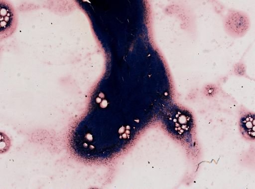 Trypanosoma