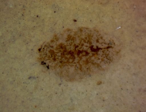 undet. Coleoptera