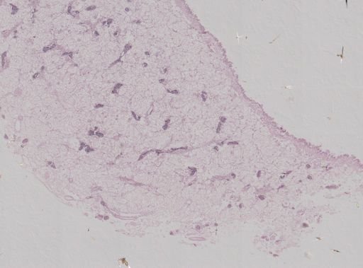Modiolus