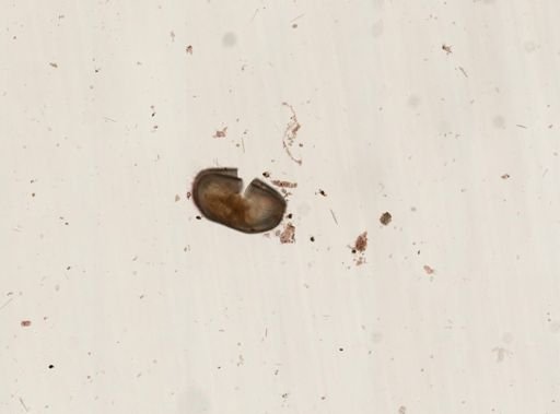 Condylostoma