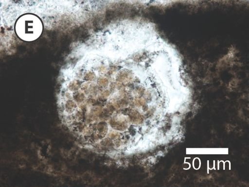 Megasphaera miniscula