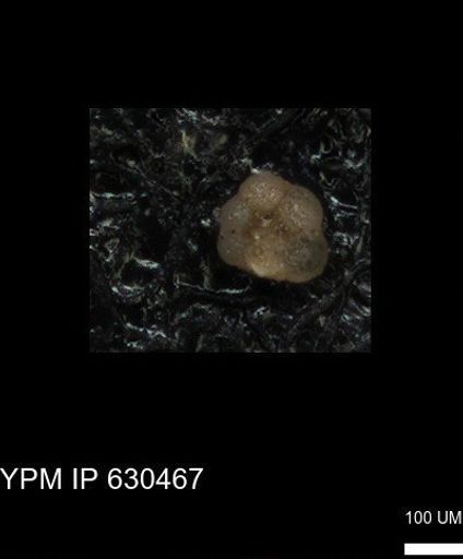 undet. Rugoglobigerinidae