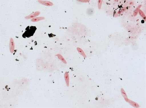 Paramecium aurelia