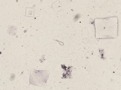 Onchocerca volvulus