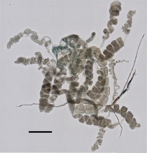 Forskalia asymmetrica