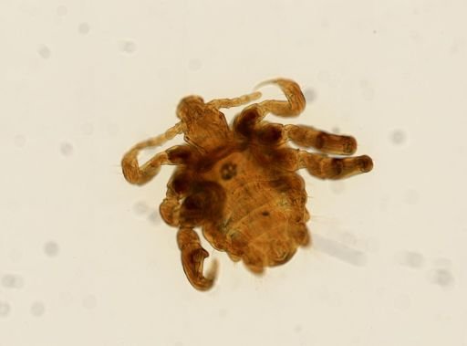 Pthirus pubis
