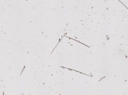 Asteropus