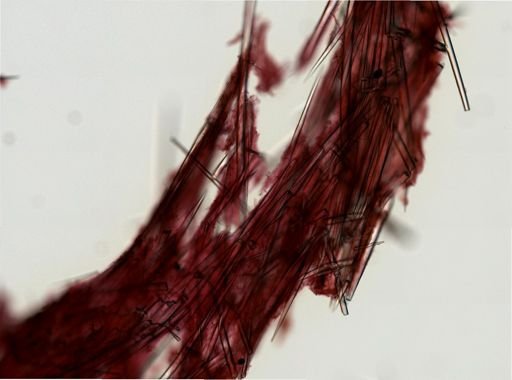 Asteropus ketostea