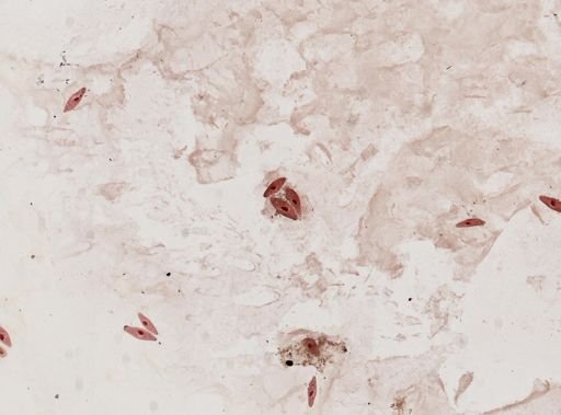 Paramecium