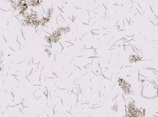 Haliclonidae