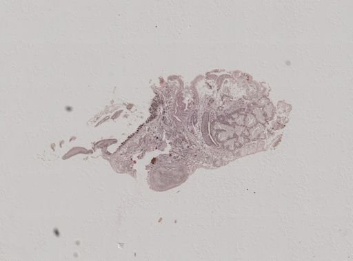 Crepidula convexa