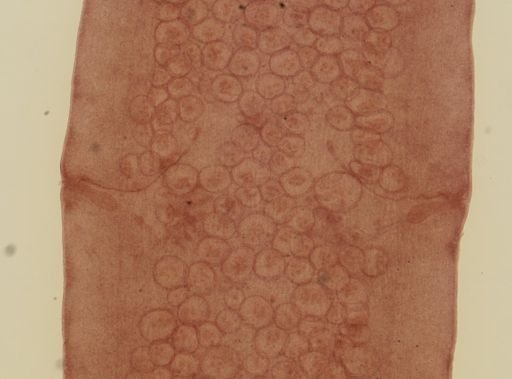 Dipylidium caninum