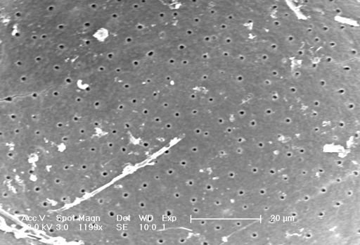 Globigerina bulloides