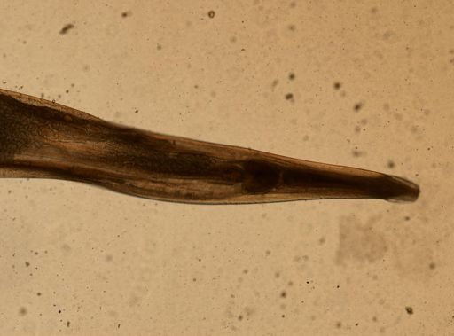 Enterobius vermicularis