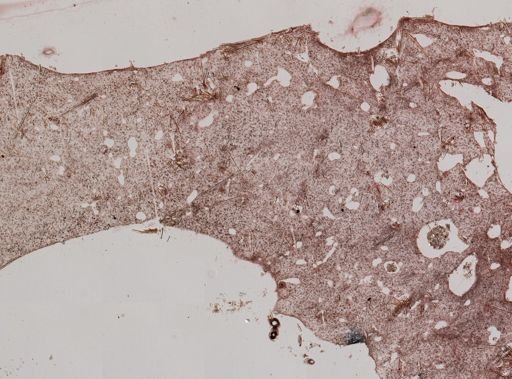 Halichondria