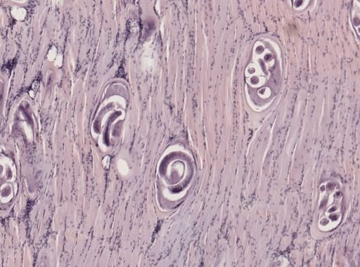 Trichinella spiralis