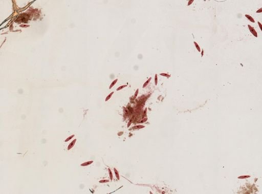 Paramecium