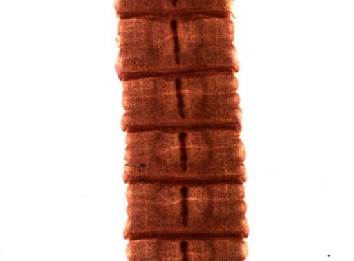 Diphyllobothrium erinacei