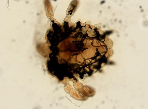 Pthirus pubis