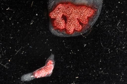 Bryozoa