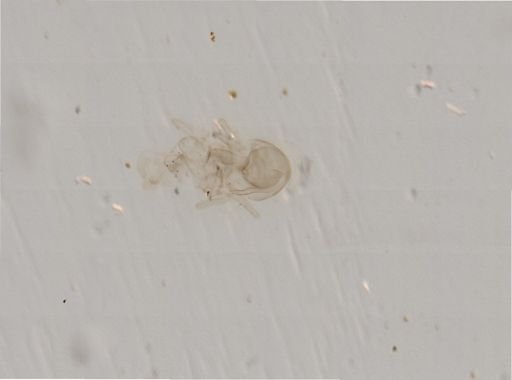 Asterias?