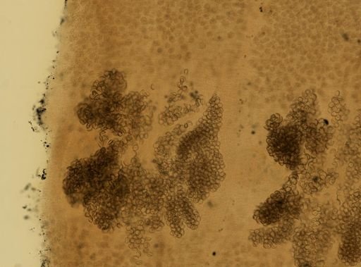 Diphyllobothrium latum