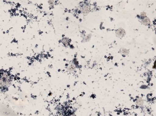 Monocystis
