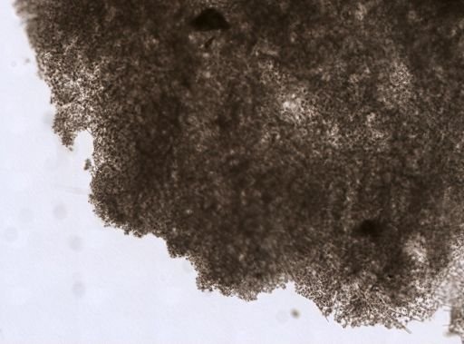 Spirastrella