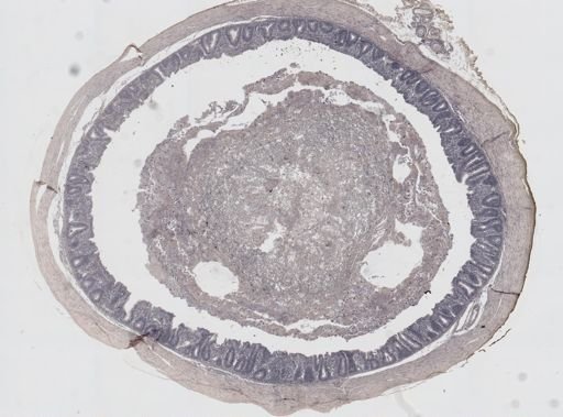 Eimeria meleagrimitis