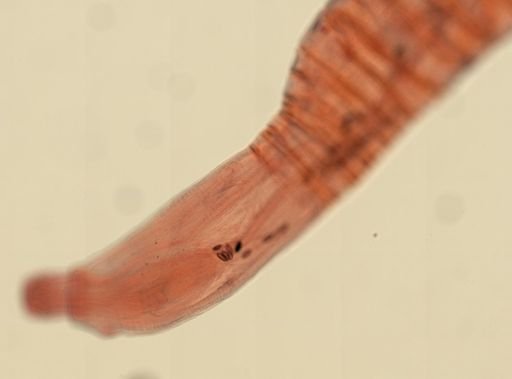 Oligacanthorhynchus microcephalus