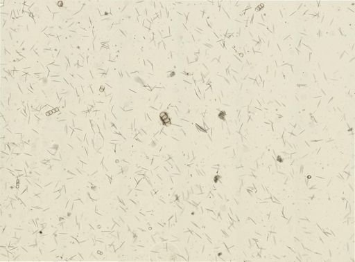 Chalinula loosanoffi