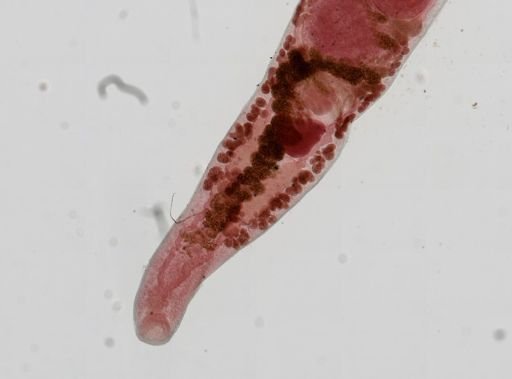 Haematoloechus medioplexus