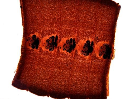 Diphyllobothrium erinacei