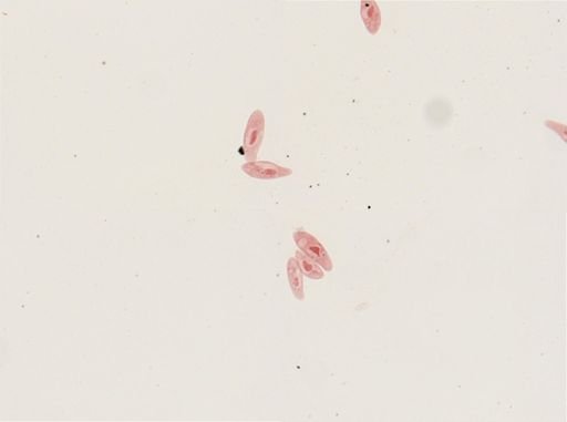 Paramecium aurelia