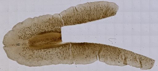 Enchiridium periommatum