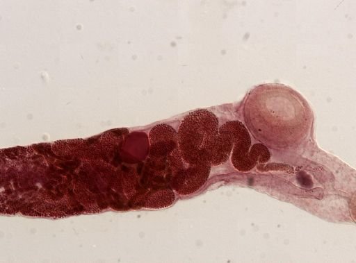 Gorgoderina