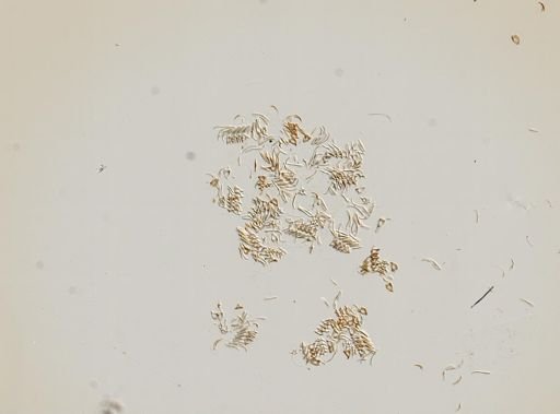 Somatogyrus subglobosus